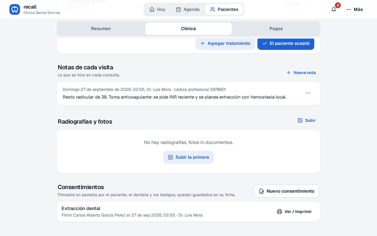 Bloque Consentimientos en la ficha de Carlos Alberto García Pérez en Recall con el botón Nuevo consentimiento y uno firmado: Extracción dental, firmó Carlos Alberto García Pérez el 27 de sep 2026, Dr. Luis Mora, con Ver / Imprimir