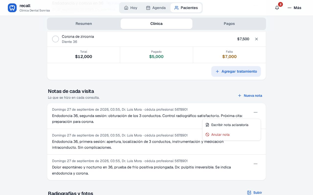 Menú ⋯ de una nota en Recall con las opciones Escribir nota aclaratoria y Anular nota