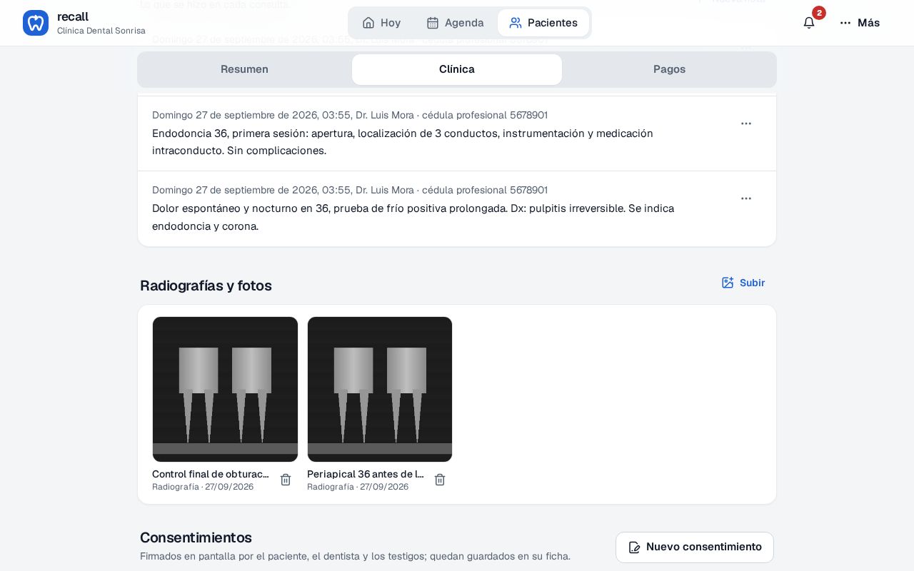 Bloque Radiografías y fotos en la ficha de José Luis Ramírez en Recall con dos radiografías periapicales en miniatura, su descripción, el tipo, la fecha y el botón Subir