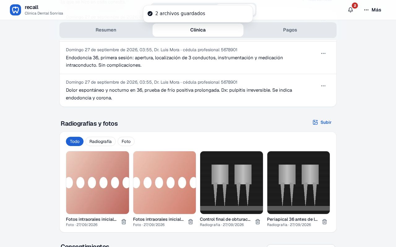 Aviso 2 archivos guardados y la cuadrícula Radiografías y fotos de Recall con los filtros Todo, Radiografía y Foto, dos fotos intraorales y dos radiografías