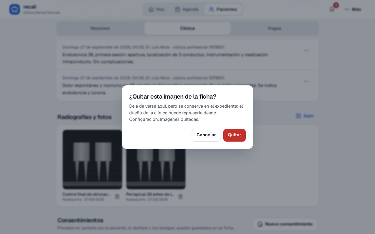 Diálogo ¿Quitar esta imagen de la ficha? en Recall, que explica que se conserva en el expediente y el dueño puede regresarla desde Configuración